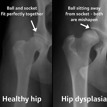 hip xray normal vs bad hip joints